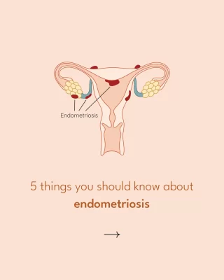 Endometriosis affects 1 in 10 women worldwide, yet it remains widely misunderstood and often misdiagnosed. This chronic condition occurs when tissue similar to the uterine lining grows outside the uterus, leading to severe pain, heavy periods, infertility, and other debilitating symptoms.
🔸 Why Awareness Matters:
- Many women suffer for years before getting a proper diagnosis.
- Symptoms are often dismissed as "just bad and painful periods."
- Increased awareness leads to better research, treatment options, and support.
Let’s break the silence and support those living with endometriosis. Awareness brings change! 💛
.
.
#endometriosis #endometriosisawarenessmonth #endometriosisproblems #endocrinologist #ovulationpain #endometriosismarch #awarenessmonth #exhaustion #IBS #irritablebowelsyndrome #pelvicpain #fibroids #pcos #gallstones #irritablebladder #crohnsdisease #exhaustion #heavybleeding #periodbleeding #diarrhoea #ovulationpain