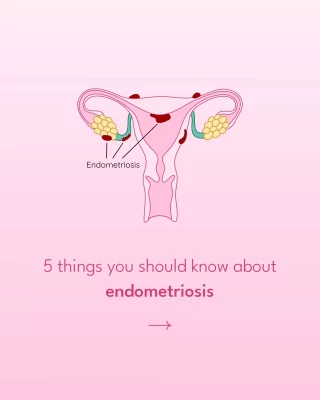 Endometriosis affects 1 in 10 women worldwide, yet it remains widely misunderstood and often misdiagnosed. This chronic condition occurs when tissue similar to the uterine lining grows outside the uterus, leading to severe pain, heavy periods, infertility, and other debilitating symptoms.
🔸 Why Awareness Matters:
- Many women suffer for years before getting a proper diagnosis.
- Symptoms are often dismissed as "just bad and painful periods."
- Increased awareness leads to better research, treatment options, and support.
Let’s break the silence and support those living with endometriosis. Awareness brings change! 💛
.
.
#endometriosis #endometriosisawarenessmonth #endometriosisproblems #endocrinologist #ovulationpain endometriosismarch